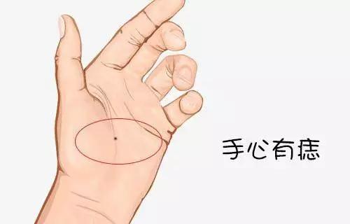 手上的痣相代表什么
